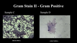 Gram Stain II - Gram Positive
Sample C Sample D
RBCR 30P01A AMGP 30P01A
 
