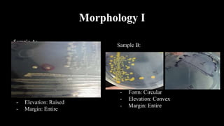 Morphology I
Sample A:
- Form: Circular
- Elevation: Raised
- Margin: Entire
Sample B:
- Form: Circular
- Elevation: Convex
- Margin: Entire
 