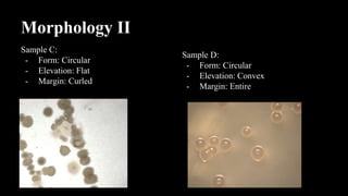 Morphology II
Sample C:
- Form: Circular
- Elevation: Flat
- Margin: Curled
Sample D:
- Form: Circular
- Elevation: Convex
- Margin: Entire
 
