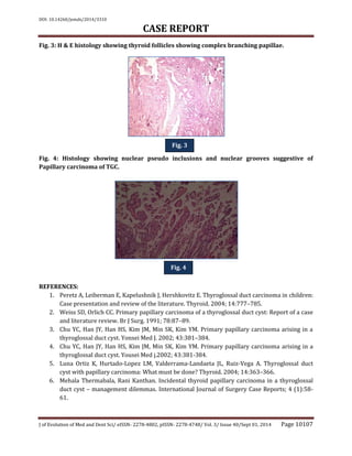 DOI: 10.14260/jemds/2014/3310
CASE REPORT
J of Evolution of Med and Dent Sci/ eISSN- 2278-4802, pISSN- 2278-4748/ Vol. 3/ Issue 40/Sept 01, 2014 Page 10107
Fig. 3: H & E histology showing thyroid follicles showing complex branching papillae.
Fig. 4: Histology showing nuclear pseudo inclusions and nuclear grooves suggestive of
Papillary carcinoma of TGC.
REFERENCES:
1. Peretz A, Leiberman E, Kapelushnik J, Hershkovitz E. Thyroglossal duct carcinoma in children:
Case presentation and review of the literature. Thyroid. 2004; 14:777–785.
2. Weiss SD, Orlich CC. Primary papillary carcinoma of a thyroglossal duct cyst: Report of a case
and literature review. Br J Surg. 1991; 78:87–89.
3. Chu YC, Han JY, Han HS, Kim JM, Min SK, Kim YM. Primary papillary carcinoma arising in a
thyroglossal duct cyst. Yonsei Med J. 2002; 43:381–384.
4. Chu YC, Han JY, Han HS, Kim JM, Min SK, Kim YM. Primary papillary carcinoma arising in a
thyroglossal duct cyst. Yousei Med j.2002; 43:381-384.
5. Luna Ortiz K, Hurtado-Lopez LM, Valderrama-Landaeta JL, Ruiz-Vega A. Thyroglossal duct
cyst with papillary carcinoma: What must be done? Thyroid. 2004; 14:363–366.
6. Mehala Thermabala, Rani Kanthan. Incidental thyroid papillary carcinoma in a thyroglossal
duct cyst – management dilemmas. International Journal of Surgery Case Reports; 4 (1):58-
61.
Fig. 3
Fig. 4
 