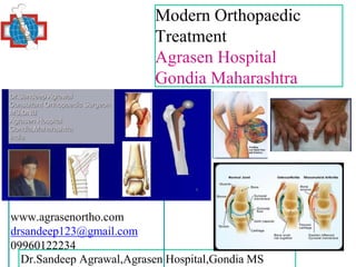Dr.Sandeep Agrawal,Agrasen Hospital,Gondia MS
Modern Orthopaedic
Treatment
Agrasen Hospital
Gondia Maharashtra
1
www.agrasenortho.com
drsandeep123@gmail.com
09960122234
 