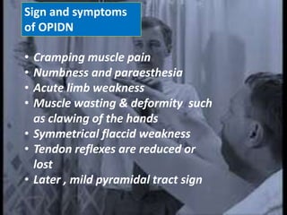 Sign and symptoms
of OPIDN
• Cramping muscle pain
• Numbness and paraesthesia
• Acute limb weakness
• Muscle wasting & deformity such
as clawing of the hands
• Symmetrical flaccid weakness
• Tendon reflexes are reduced or
lost
• Later , mild pyramidal tract sign
 