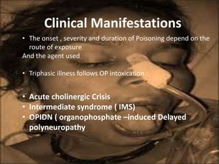 Clinical Manifestations
• The onset , severity and duration of Poisoning depend on the
route of exposure
And the agent used
• Triphasic illness follows OP intoxication :
• Acute cholinergic Crisis
• Intermediate syndrome ( IMS)
• OPIDN ( organophosphate –induced Delayed
polyneuropathy
 