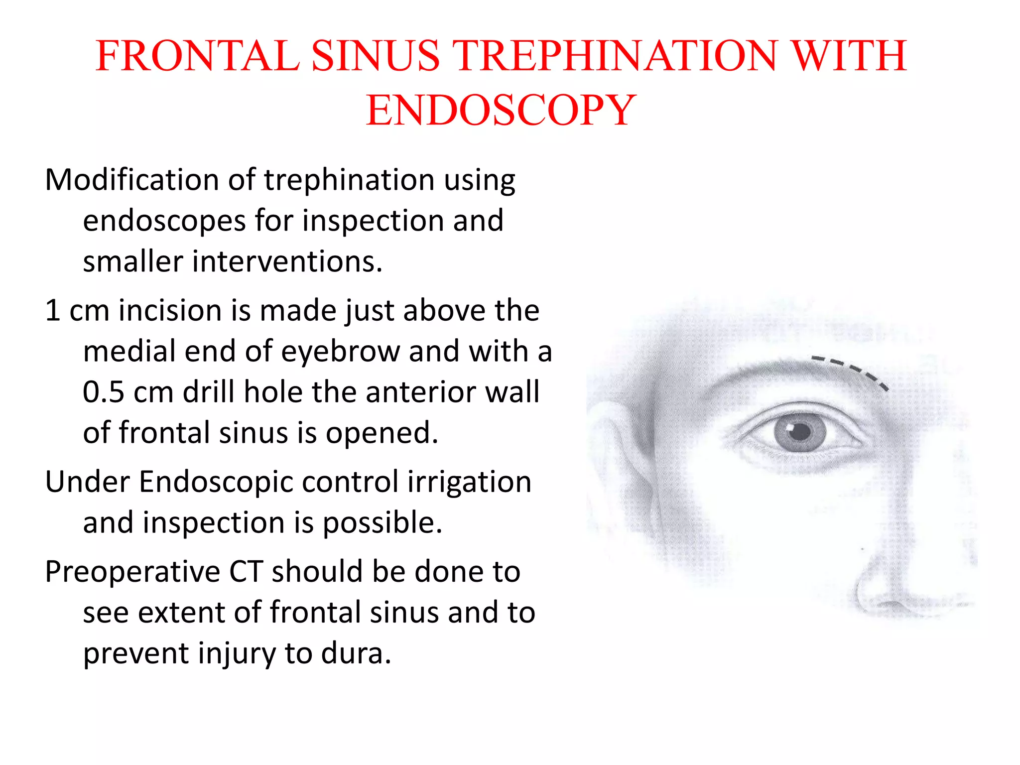 surgical approaches to frontal sinus ppt | PPTX