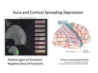 Aura and Cortical Spreading Depression
Positive (gain‐of‐function) 
Negative (loss‐of‐function)
Ferrari, M. D., et al. (2015). The Lancet. 
http://doi.org/10.1016/S1474‐4422(14)70220‐0
 