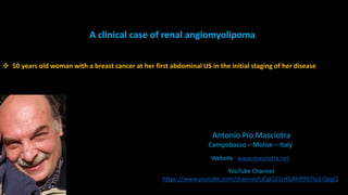 Antonio Pio Masciotra
Campobasso – Molise – Italy
Website www.masciotra.net
YouTube Channel
https://www.youtube.com/channel/UCgCj21nKGAhR997Ia3-QegQ
A clinical case of renal angiomyolipoma
 50 years old woman with a breast cancer at her first abdominal US in the initial staging of her disease
 