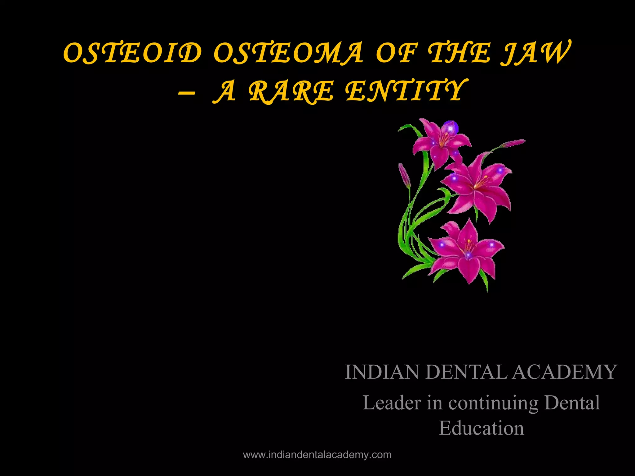 osteoid osteoma of the jaw /dental courses PPT
