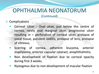 OPHTHALMIA NEONATORUM
(Continued)
 Complications
 Corneal Ulcer : Oval ulcer, just below the centre of
cornea, rarely oval marginal ulcer, progressive ulcer
resulting in – perforation of corneal ulcer, prolapse of
uveal tissue, purulent uveitis, prolapse of lens, prolapse
of vitreous.
 Scarring of cornea, adherent leucoma, anterior
staphyloma, anterior capsular cataract, anophthalmitis.
 Non development of fixation due to corneal opacity
during first 3 weeks.
 Nystagmus due to non-development of macular fixation
20
 