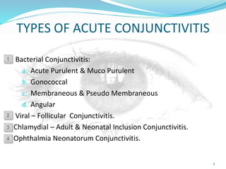 TYPES OF ACUTE CONJUNCTIVITIS
Bacterial Conjunctivitis:
a. Acute Purulent & Muco Purulent
b. Gonococcal
c. Membraneous & Pseudo Membraneous
d. Angular
Viral – Follicular Conjunctivitis.
Chlamydial – Adult & Neonatal Inclusion Conjunctivitis.
Ophthalmia Neonatorum Conjunctivitis.
5
1
2
3
4
 
