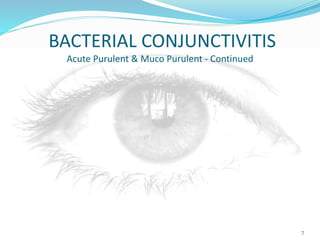 BACTERIAL CONJUNCTIVITIS
Acute Purulent & Muco Purulent - Continued
7
 