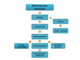 Cotton – wool spot
Neovascularization
Ischemia
Neovascular
glaucoma
Microvascular
Occlusion
Fibrovascular bands
Vitreous
hemorrhage
Increased VEGF
Tractional retinal
detachment
Infarction
 
