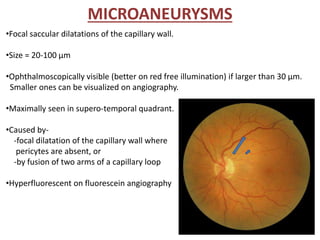 MICROANEURYSMS
•Focal saccular dilatations of the capillary wall.
•Size = 20-100 µm
•Ophthalmoscopically visible (better on red free illumination) if larger than 30 µm.
Smaller ones can be visualized on angiography.
•Maximally seen in supero-temporal quadrant.
•Caused by-
-focal dilatation of the capillary wall where
pericytes are absent, or
-by fusion of two arms of a capillary loop
•Hyperfluorescent on fluorescein angiography
 