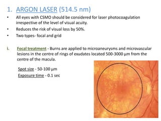 1. ARGON LASER (514.5 nm)
• All eyes with CSMO should be considered for laser photocoagulation
irrespective of the level of visual acuity.
• Reduces the risk of visual loss by 50%.
• Two types- focal and grid
i. Focal treatment - Burns are applied to microaneurysms and microvascular
lesions in the centre of rings of exudates located 500-3000 µm from the
centre of the macula.
Spot size - 50-100 µm
Exposure time - 0.1 sec
 