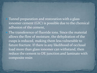  Tunnel preparation and restoration with a glass
ionomer cement (GIC) is possible due to the chemical
adhesion of the cement,
The transference of fluoride ions. Since the material
allows the flow of moisture, the dehydration of the
cusps is reduced, making them less vulnerable to
future fracture. If there is any likelihood of occlusal
load more than glass ionomer can withstand, then
reduce the cement to DE junction and laminate with
composite resin