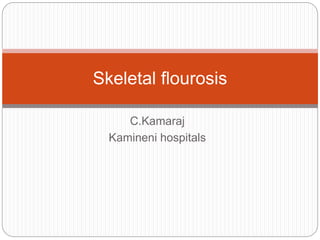 C.Kamaraj
Kamineni hospitals
Skeletal flourosis
 