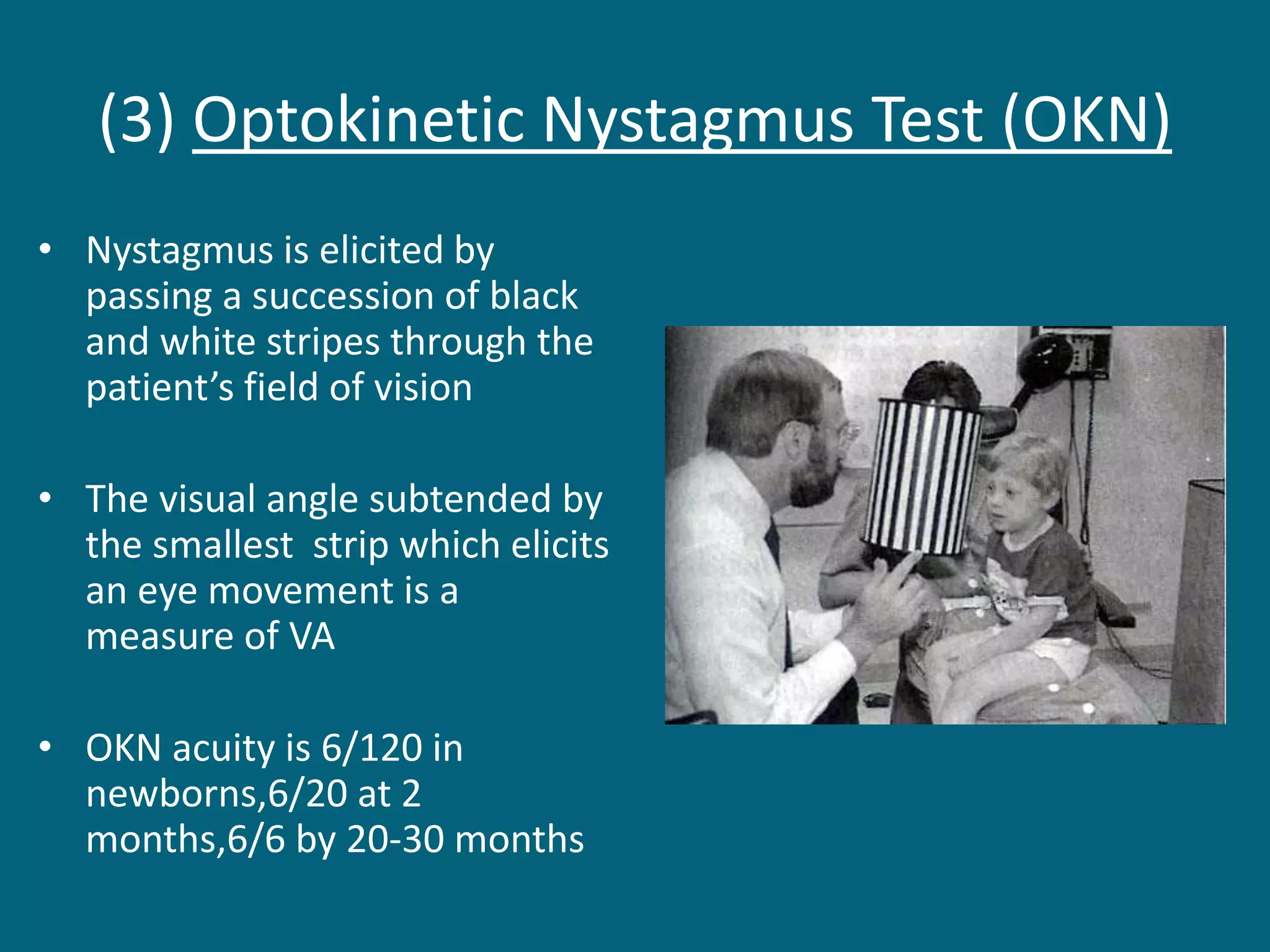(3) Optokinetic Nystagmus Test (OKN)
• Nystagmus is elicited by
passing a succession of black
and white stripes through the
patient’s field of vision
• The visual angle subtended by
the smallest strip which elicits
an eye movement is a
measure of VA
• OKN acuity is 6/120 in
newborns,6/20 at 2
months,6/6 by 20-30 months
 