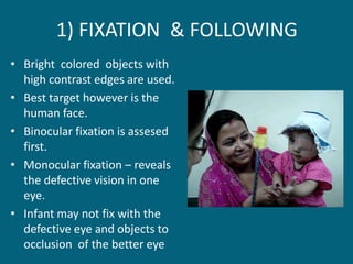 1) FIXATION & FOLLOWING
• Bright colored objects with
high contrast edges are used.
• Best target however is the
human face.
• Binocular fixation is assesed
first.
• Monocular fixation – reveals
the defective vision in one
eye.
• Infant may not fix with the
defective eye and objects to
occlusion of the better eye
 