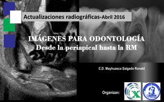 C.D. Mayhuasca Salgado Ronald
IMÁGENES PARA ODONTOLOGÍA
Desde la periapical hasta la RM
Actualizaciones radiográficas-Abril 2016
Organizan:
 