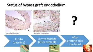 Invited Presentation: Ex Vivo Storage of Vein Grafts