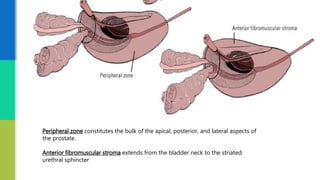 Peripheral zone constitutes the bulk of the apical, posterior, and lateral aspects of
the prostate.
Anterior fibromuscular stroma extends from the bladder neck to the striated
urethral sphincter
 