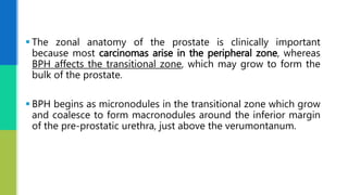  The zonal anatomy of the prostate is clinically important
because most carcinomas arise in the peripheral zone, whereas
BPH affects the transitional zone, which may grow to form the
bulk of the prostate.
 BPH begins as micronodules in the transitional zone which grow
and coalesce to form macronodules around the inferior margin
of the pre-prostatic urethra, just above the verumontanum.
 