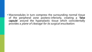  Macronodules in turn compress the surrounding normal tissue
of the peripheral zone postero-inferiorly, creating a ‘false
capsule' around the hyperplastic tissue which coincidentally
provides a plane of cleavage for its surgical enucleation.
 