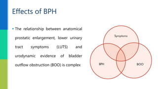  The relationship between anatomical
prostatic enlargement, lower urinary
tract symptoms (LUTS) and
urodynamic evidence of bladder
outflow obstruction (BOO) is complex
Effects of BPH
 