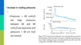  Increase in voiding pressures
:
 Pressures > 80 cmH2O
are high, pressures
between 60 and 80
cmH2O are equivocal and
pressures < 60 cm H2O
are normal.
 