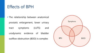  The pathophysiology of
benign prostatic
hyperplasia (BPH)
involves complex
interactions between
urethral obstruction,
de...