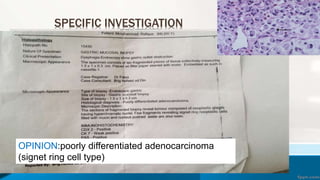 SPECIFIC INVESTIGATION
CT SCAN ABDOMEN AND PELVIS WITH IV CONTRAST
IMPRESSION: Markedly distended stomach representing gastric
outlet obstruction with irregular thickness and pyloric growth most
likely represent gastric mass
CONCLUSION: Gastruc outlet obstruction due to an ulcerating
polypoidal mass
OPINION:poorly differentiated adenocarcinoma
(signet ring cell type)
 