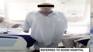 POST OPERATIVE CARE:
 Keep patient in intensive care unit
 Strict monitoring of electrolyte balance
 Keep a check on drainage (ng,abdomianl/pelvis drains)
 Monitor hourly vitals
 Iv antibiotics
 Iv pain killers
1st OP DAY 7TH POST OP DAY
REFERRED TO NOORI HOSPITAL
 