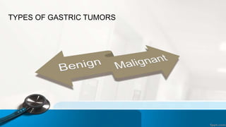TYPES OF GASTRIC TUMORS
 