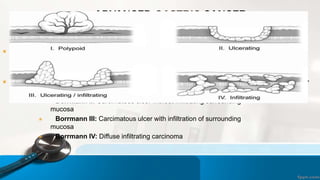ADVANCED GASTRIC CANCER:
 The vast majority of gastric cancer are of advanced which deeply penetrate the stomach wall,
invade the adjacent structures with lymphatic & haematogenous metastasis.
 Advanced gastric cancer classified according to the Bormann's morphologic description as –
 Borrmann I: Fungating
 Borrmann II: Carcimatous ulcer without infiltrating surrounding
mucosa
 Borrmann III: Carcimatous ulcer with infiltration of surrounding
mucosa
 Borrmann IV: Diffuse infiltrating carcinoma
 
