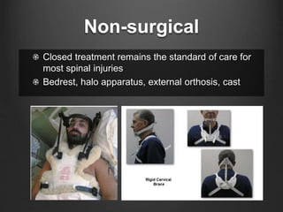 Non-surgical
Closed treatment remains the standard of care for
most spinal injuries
Bedrest, halo apparatus, external orthosis, cast
 