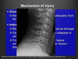 Mechanism of injury
Direct injury
Penetrating injuries to the spine, particularly from
firearms and knives
Indirect injury
Most common cause of significant spinal damage
Fall from a height  spinal column collapses in
vertical axis
Forces: axial compression, flexion, lateral
compression, flexion-rotation, shear, flexion-
distraction and extension
Eisenstein S, Marsy WE. Injuries of the spine. Apley’s System of Orthopaedics and Fractures. 9th edition. 2010
 