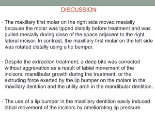 case report Presented By Dr. MUSTAFA HADDAD from (Angle Orthodontist ...