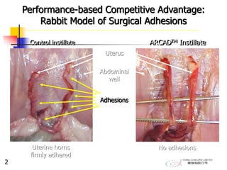 Performance-based Competitive Advantage:
Rabbit Model of Surgical Adhesions
Control instillate
Uterine horns
firmly adhered
ARCADTM Instillate
No adhesions
Uterus
Abdominal
wall
Adhesions
2
 