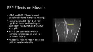 PRP Effects on Muscle
• IGF-1 and FGF -2 have should
beneficial effects in muscle healing
• In murine model IGF-1 ,b FGF
cytokines improved healing and
significant fast twitch and tetanus
strength
• TGF-B can cause detrimental
increase in fibrosis and lead to
recurrent injury
• Anecdotal reports report decrease
in time to return to play
 