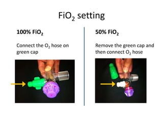 Disposable Ventilator-A dream or reality | PPTX