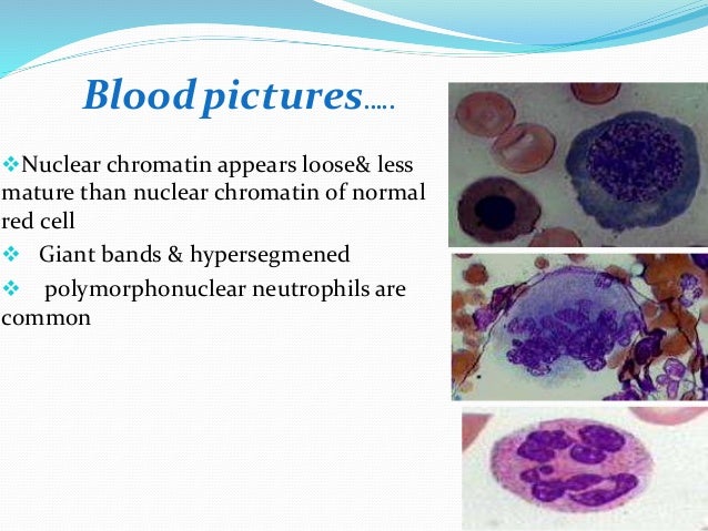 Haematopoitic vitamin,pathogenesis of megaloblastic ...