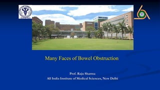 Many Faces of Bowel Obstruction
Prof. Raju Sharma
All India Institute of Medical Sciences, New Delhi
 