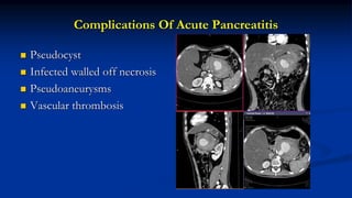 Complications Of Acute Pancreatitis
 Pseudocyst
 Infected walled off necrosis
 Pseudoaneurysms
 Vascular thrombosis
 