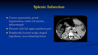 Splenic Infarction
 Causes: pancreatitis, portal
hypertension, sickle cell anemia,
splenomegaly
 Presents with left upper quadrant pain
 Peripherally located wedge shaped
hypodense, non-enhancing lesion
 