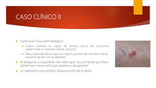 CASO CLÍNICO II
 Exploración física dermatológica:
 Cicatriz pretibial sin signos de recidiva clínica del carcinoma
epidermoide en miembro inferior izquierdo
 Placa eritemato-descamativa en región pretibial del miembro inferior
izquierdo de 6x6 mm de diámetro
 Al preguntar a la paciente nos indica que “es una herida que tiene
desde hace meses-años que aparece y desaparece”.
 Le realizamos iconografía y biopsia-punch de la lesión
 