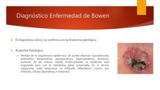 Diagnóstico Enfermedad de Bowen
 El diagnóstico clínico se confirma con la Anatomía patológica
 Anatomía Patológica
 Pérdida de la arquitectura epidérmica. Se puede observar: queratinocitos
polimorfos, disqueratosis, paraqueratosis, hiperqueratosis, acantosis,
aumento de las mitosis, células multinucleadas. La epidermis está
engrosada pero con la membrana basal conservada. En la dermis
subyacente suele observarse un infiltrado inflamatorio crónico con
linfocitos, células plasmáticas e histiocitos.
 