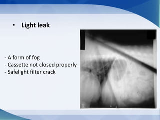 • Light leak
- A form of fog
- Cassette not closed properly
- Safelight filter crack
 