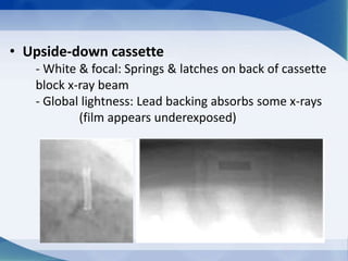 • Upside-down cassette
- White & focal: Springs & latches on back of cassette
block x-ray beam
- Global lightness: Lead backing absorbs some x-rays
(film appears underexposed)
 