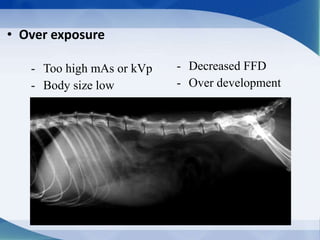 • Over exposure
- Too high mAs or kVp
- Body size low
- Decreased FFD
- Over development
 