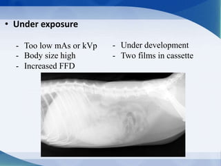 • Under exposure
- Too low mAs or kVp
- Body size high
- Increased FFD
- Under development
- Two films in cassette
 