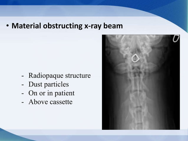 Rarefaction Radiograph Radiographic artifacts | PPTX